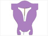 Gynefix Kupferkette